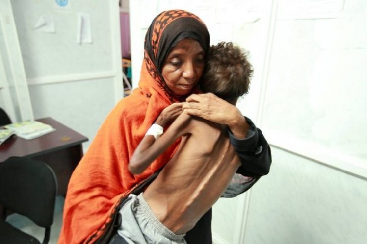 Υεμένη: Όσοι δεν πεθαίνουν από τις βόμβες, πεθαίνουν από πείνα