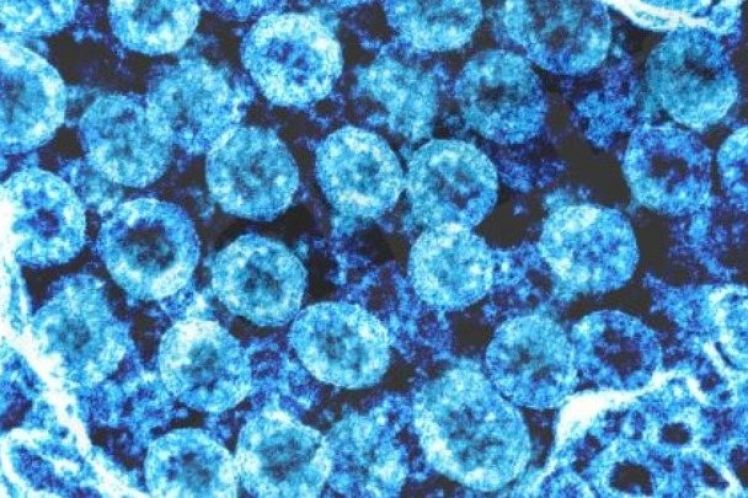 ΟΟΣΑ-Covid-19: Η παγκόσμια ανάπτυξη θα συρρικνωθεί εξαιτίας της επιδημίας
