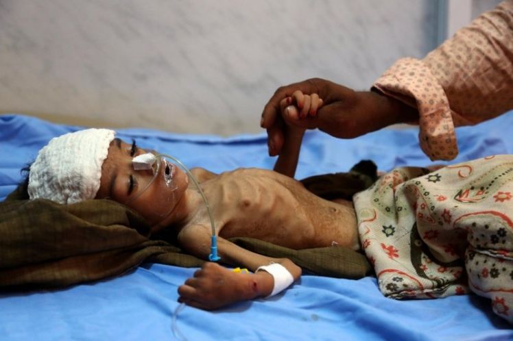 Unicef: Οι συνέπειες του κορονοϊού θα σκοτώσουν χιλιάδες παιδιά