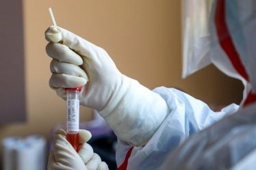 Η Covid-19 μπορεί να προκαλέσει προσωρινές μειώσεις στο προσδόκιμο ζωής…