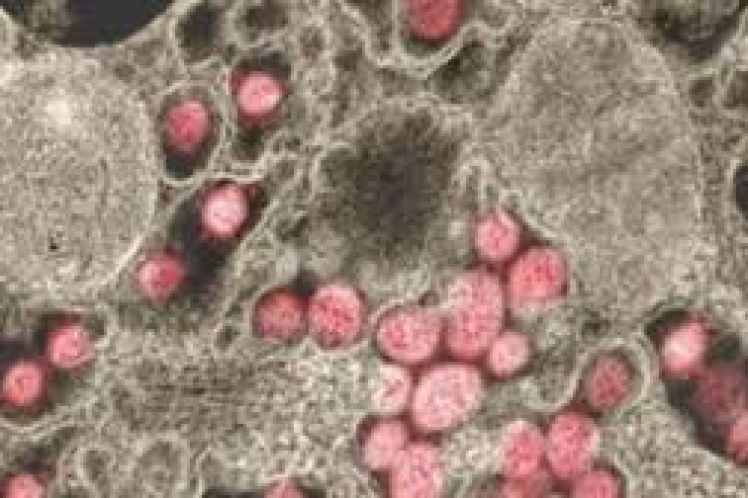 Covid-19: Το μονοκλωνικό αντίσωμα bamlanivimab μειώνει τον κίνδυνο στους ηλικιωμένους