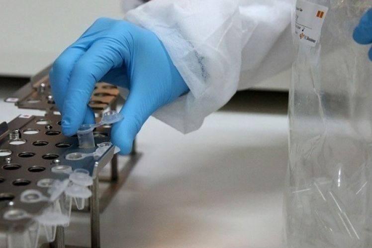 Κορονοϊός: 928 κρούσματα, 405 διασωληνωμένοι, 40 θάνατοι