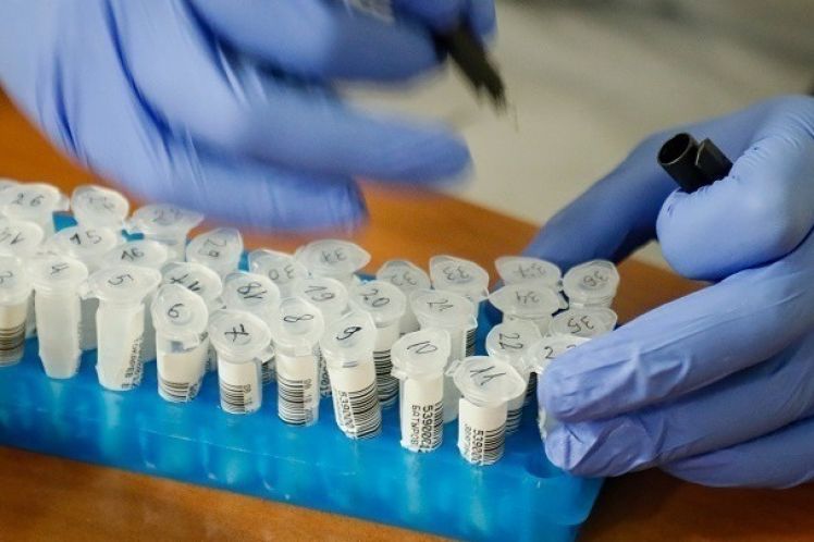 2.535 νέα κρούσματα της νόσου COVID-19 , 672 διασωληνωμένοι, 60 θάνατοι το τελευταίο 24 ωρο