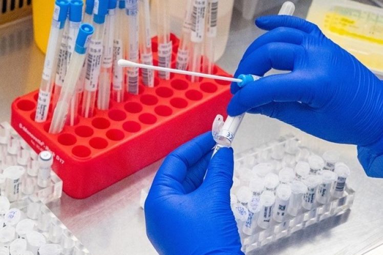 Τι γνωρίζουμε και τι όχι για την νέα υποπαραλλαγή του SARS-CoV2, JN.1 – Τι να προσέχουμε στο εορταστικό τραπέζι