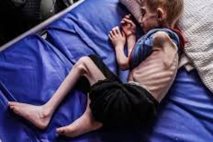 Παγκόσμια Έκθεση: 281 εκατομμύρια άνθρωποι λιμοκτονούν