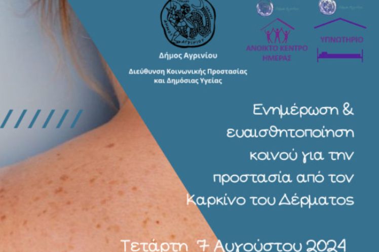 ΕΝΗΜΕΡΩΤΙΚΗ ΔΡΑΣΗ ΤΩΝ ΔΟΜΩΝ ΑΣΤΕΓΩΝ